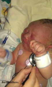 My son, one day old in the NICU. He is still on the blue scale but the doctors felt he was doing well.